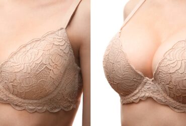 augmenter seins sans chirurgie