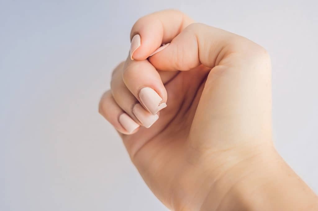 ongle casse