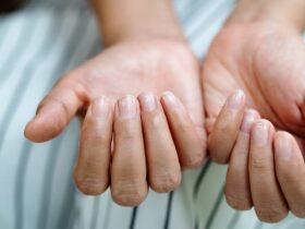 ongles fragiles apres manucure permanente