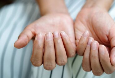 ongles fragiles apres manucure permanente